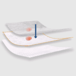 aluderm-Slider-Bilder04